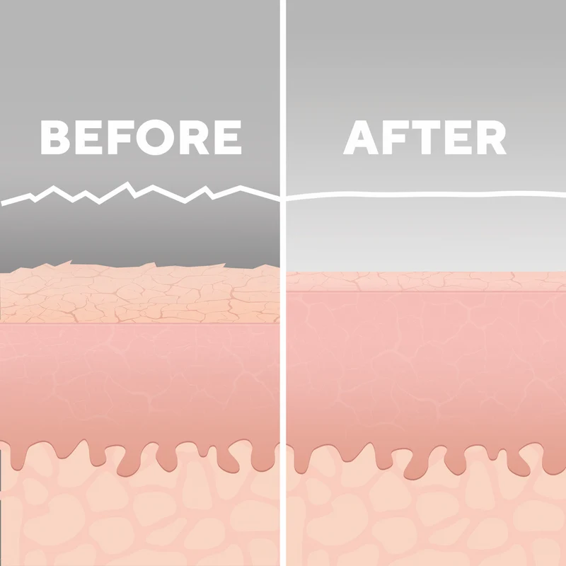 Homedics Radiance Microdermabrasion with Cooling